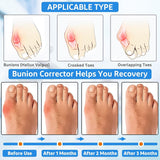 Healrecux Bunion Corrector for Women Big Toe, 2Pcs Bunion Toe Corrector, Adjustable Big Toe Straightener with 2 Gel Toe Separators for Bunion Pain Relief, Comfortable Hallux Valgus Corrector for Men